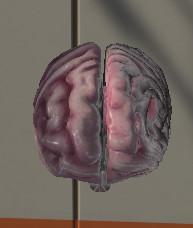 外科研究院的3D骨骼（Surgical Study and 3D Skeletons for Medical School Students ）