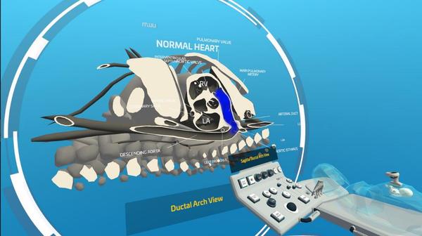 心脏病医学VR 汉化中文版（Fetal Heart VR）- Meta Quest游戏